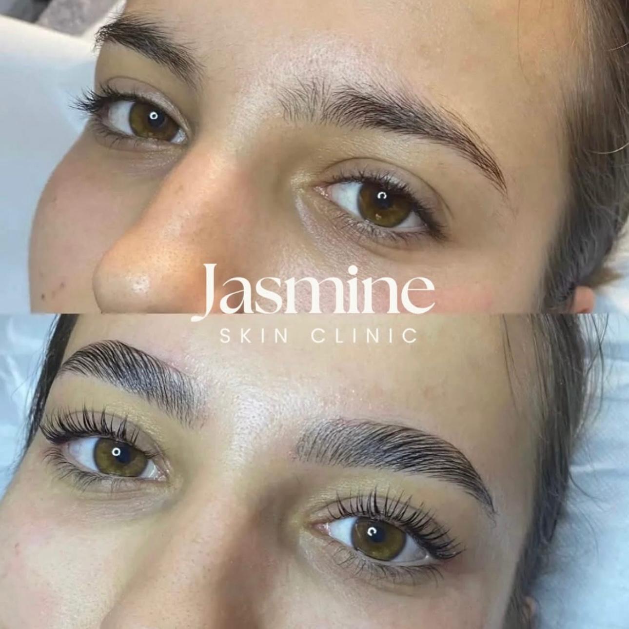 Brow Lift sourcils avant après – Jasmine Skin Clinic